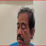 চিকিৎসকের ওপর হামলা ও চাঁদা দাবির ঘটনায় তদন্তে অসন্তোষ