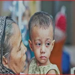 দেশে প্রতি দুই নমুনা পরীক্ষায় একজনের হাম শনাক্ত