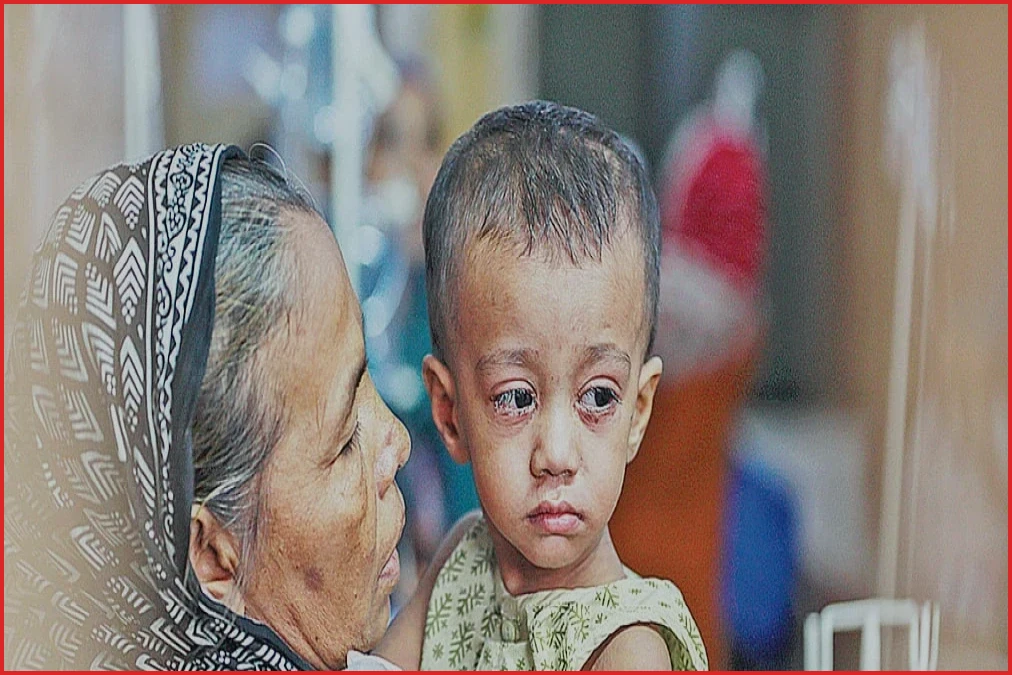 দেশে প্রতি দুই নমুনা পরীক্ষায় একজনের হাম শনাক্ত