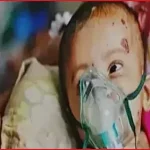 হামের উপসর্গে আরও ৩ শিশুর মৃত্যু, আক্রান্ত ৯৪০ জন