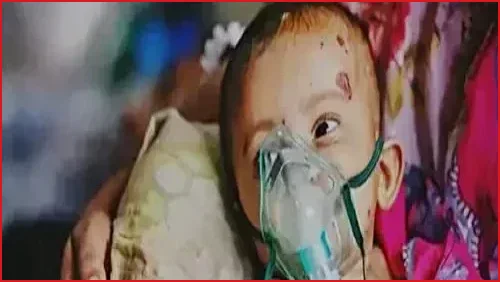 হামের উপসর্গে আরও ৩ শিশুর মৃত্যু, আক্রান্ত ৯৪০ জন